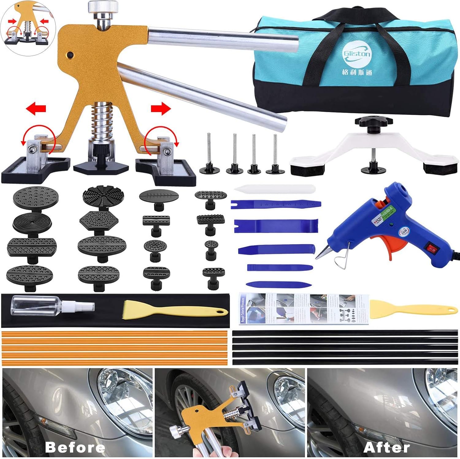 GLISTON Dent Repair Kit with Bridge Puller